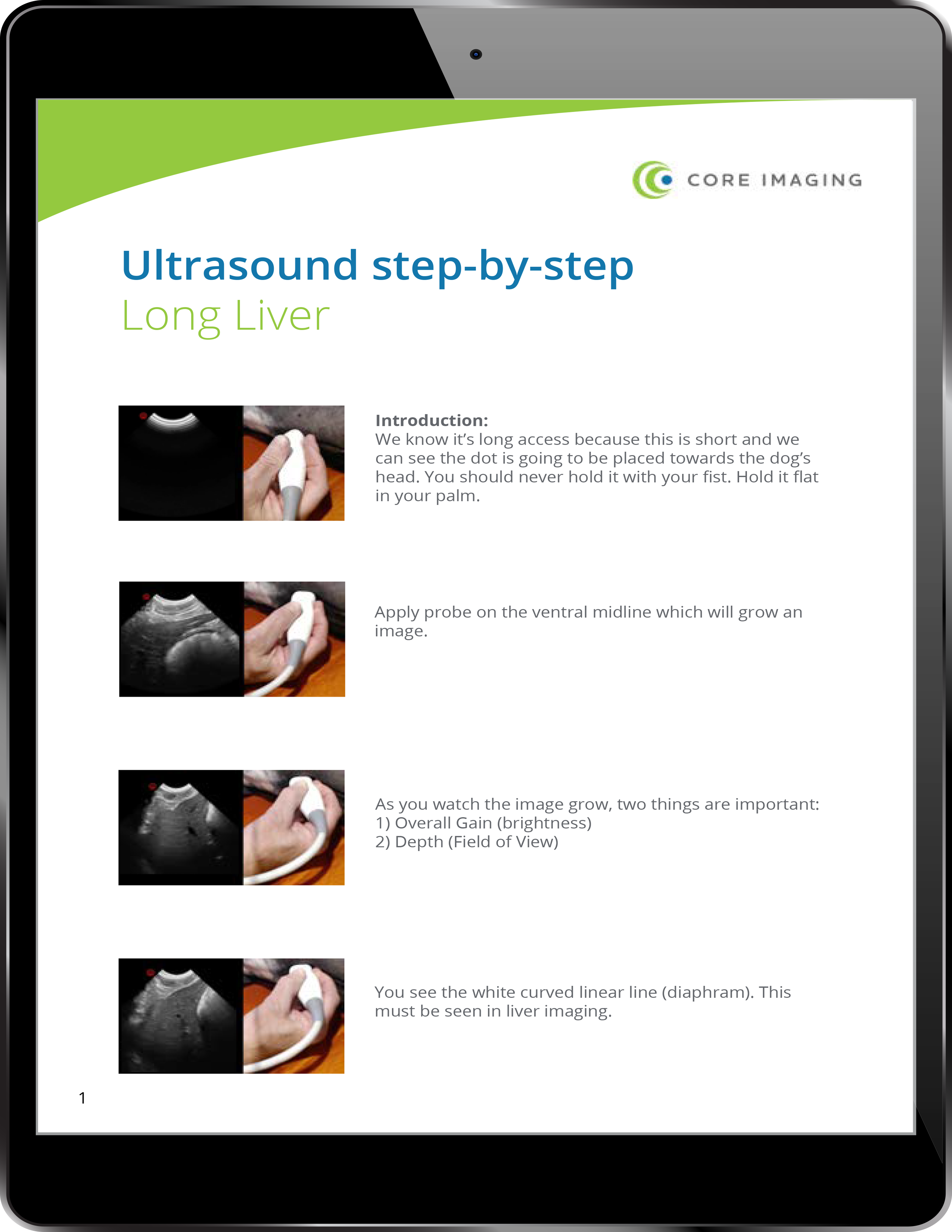 Step-by-Step Ultrasound Guide: Long Liver
